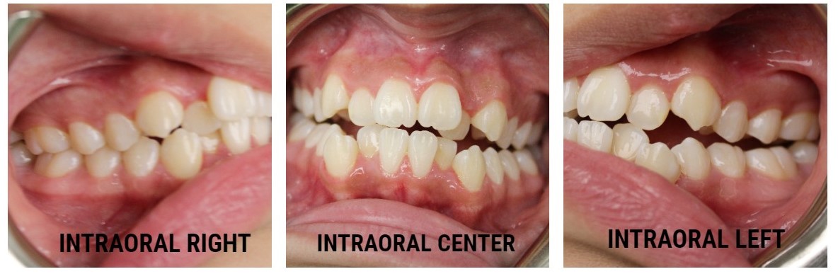 dental care garciahailey23066 2
