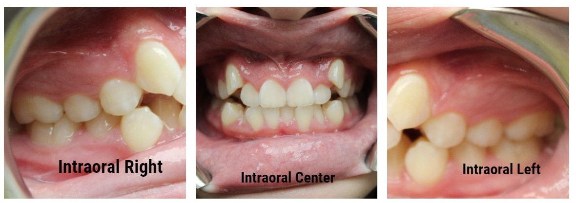 dental care gomezjade23157 1