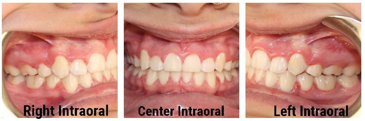 dental care gomezjade52127 1