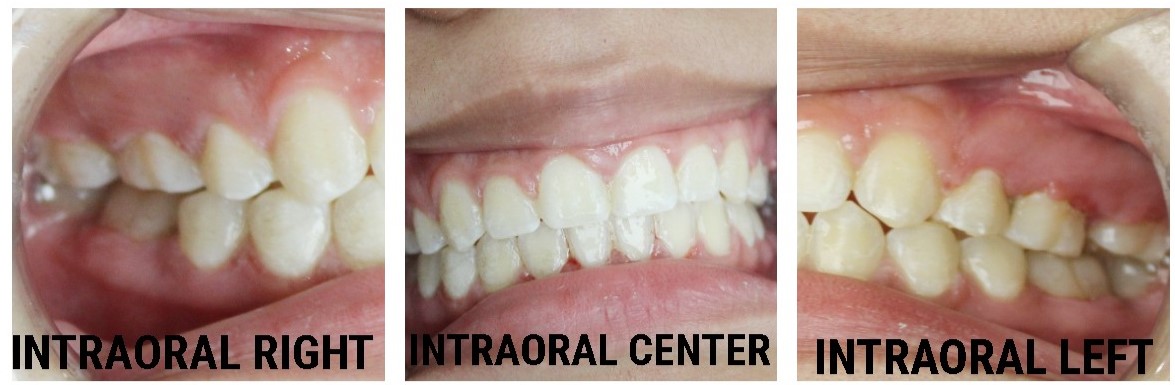 dental care jimenezdanely39496 1