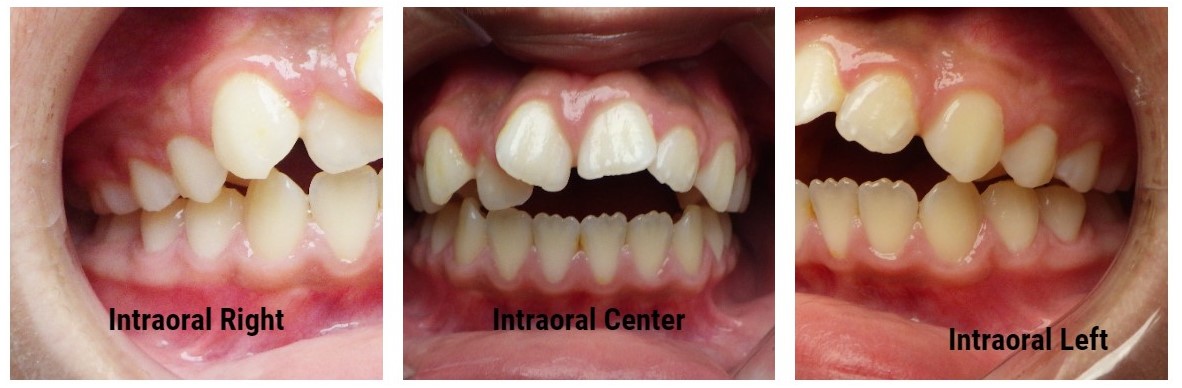 dental care jimenezdanely4256 1