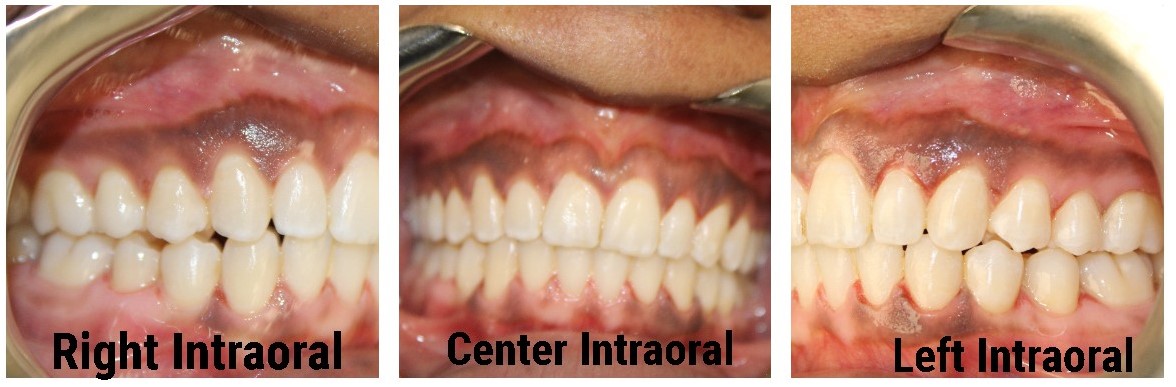 dental care sturkeystarr51226 1