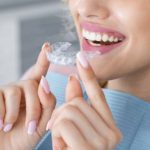 How Invisalign Fits Into Your Daily Lifestyle