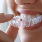 how invisalign affects speech, confidence