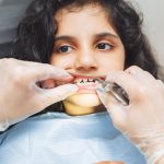 pre-prosthetic orthodontics for implants preparation guide